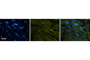 Rabbit Anti-SCN5A Antibody  Catalog Number: ARP34935_P050 Formalin Fixed Paraffin Embedded Tissue: Human Adult heart  Observed Staining: Membrane (stronger than with ARP34934) Primary Antibody Concentration: 1:600 Secondary Antibody: Donkey anti-Rabbit-Cy2/3 Secondary Antibody Concentration: 1:200 Magnification: 20X Exposure Time: 0.