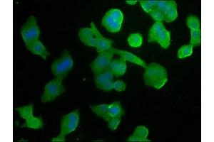 Immunofluorescence staining of PC-3 cells with ABIN7140074 at 1:266, counter-stained with DAPI. (GPR37 anticorps  (AA 114-133))