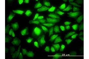 Immunofluorescence of monoclonal antibody to DNAJB6 on HeLa cell.