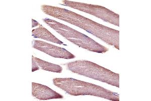 (ABIN6242693 and ABIN6578667) staining Vinculin in mouse skeletal muscle tissue sections by Immunohistochemistry (IHC-P - paraformaldehyde-fixed, paraffin-embedded sections).