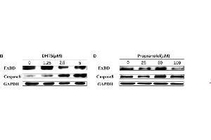 Apoptosis related proteins were detected in EOMA cells after treated with DHTS and propranolol.
