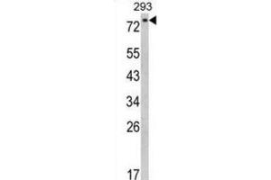 anti-EPS8-Like 3 (EPS8L3) antibody