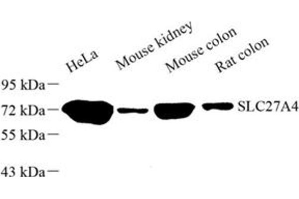 SLC27A4 Antikörper