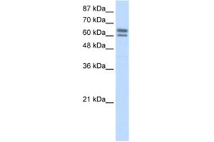 WB Suggested Anti-BTBD14B Antibody Titration:  5. (NAC1 anticorps  (C-Term))