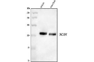 Western blot analysis of Neurocan/NCAN using anti-Neurocan/NCAN antibody (ABIN7599762).