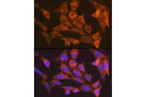 Immunofluorescence analysis of NIH-3T3 cells using CaMKII delta Rabbit mAb (ABIN7266019) at dilution of 1:100 (40x lens). (CAMK2D anticorps)
