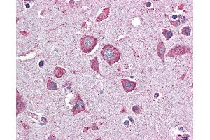 Anti-EIF2B2 / EIF2B antibody IHC of human brain, cortex.
