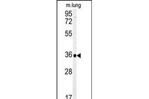 Western blot analysis of CA4 Antibody (C-term) (ABIN391691 and ABIN2841596) in mouse lung tissue lysates (35 μg/lane). (CA4 anticorps  (C-Term))