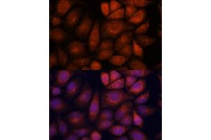 Immunofluorescence analysis of HeLa cells using KIF13A antibody (ABIN7268122) at dilution of 1:100. (KIF13A anticorps  (AA 1300-1600))