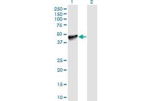 Western Blot analysis of PDCD1LG2 expression in transfected 293T cell line by PDCD1LG2 monoclonal antibody (M06), clone 7D5. (PDCD1LG2 anticorps  (AA 22-111))