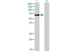 Western Blot analysis of CAMKK1 expression in transfected 293T cell line by CAMKK1 monoclonal antibody (M01A), clone 1F6. (CAMKK1 anticorps  (AA 1-520))