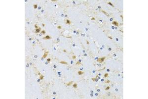 Immunohistochemistry of paraffin-embedded mouse brain using CCT4 antibody (ABIN2561655) at dilution of 1:100 (40x lens). (CCT4 anticorps)