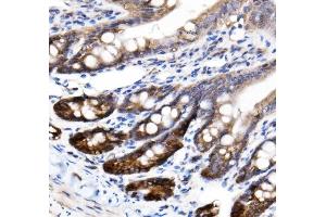 IHC analysis of NKCC1/SLC12A2 using anti-NKCC1/SLC12A2 antibody (ABIN7602602).