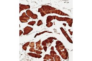 Immunohistochemical analysis of paraffin-embedded Human skeletal muscle tissue using (ABIN656331 and ABIN2845630) performed on the Leica® BOND RXm.