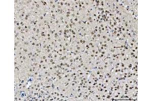 IHC analysis of CHD2 using anti-CHD2 antibody (ABIN5518901).