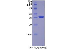 SDS-PAGE analysis of Human RUNX2 Protein. (RUNX2 Protéine)