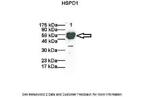 Western Blotting (WB) image for anti-Heat Shock 60kDa Protein 1 (Chaperonin) (HSPD1) (C-Term) antibody (ABIN2792215) (HSPD1 anticorps  (C-Term))