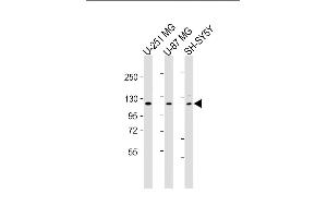 All lanes : Anti-SH3PXD2B Antibody (C-Term) at 1:2000 dilution Lane 1: U-251 MG whole cell lysate Lane 2: U-87 MG whole cell lysate Lane 3: SH-SY5Y whole cell lysate Lysates/proteins at 20 μg per lane. (SH3PXD2B anticorps  (AA 596-628))