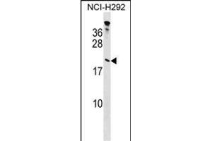 TP Antibody (Center) (ABIN1538440 and ABIN2848728) western blot analysis in NCI- cell line lysates (35 μg/lane). (Tppp anticorps  (AA 47-75))