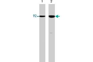 Western blot analysis of HCT-116 src transformed cells (20 mg/lane) serum starved overnight (lane 1) or treated with pervanadate (1 mM) for 30 min (lane 2). (CTNNB1 anticorps  (N-Term))