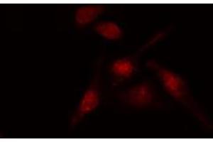 ABIN6274188 staining HT29 cells by IF/ICC. (AFT1 anticorps  (Internal Region))