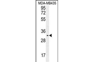 OR4K2 Antibody (C-term) (ABIN655864 and ABIN2845271) western blot analysis in MDA-M cell line lysates (35 μg/lane). (OR4K2 anticorps  (C-Term))