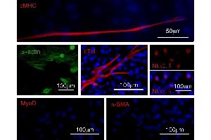 Immunofluorescence staining of contracting clone for cardiac- and muscle-proteins.