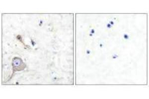 Immunohistochemical analysis of paraffin-embedded human brain tissue using S100 A1 antibody. (S1A1 anticorps)