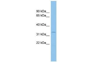 ACP5 antibody used at 1 ug/ml to detect target protein. (ACP5 anticorps  (N-Term))