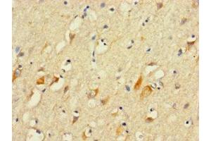 Immunohistochemistry of paraffin-embedded human brain tissue using ABIN7156163 at dilution of 1:100 (PLCL2 anticorps  (AA 2-300))