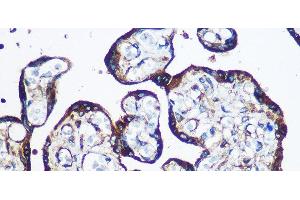 Immunohistochemistry of paraffin-embedded Human placenta using YTHDF2 Polyclonal Antibody at dilution of 1:100 (40x lens). (YTHDF2 anticorps)