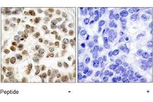 Image no. 1 for anti-Breast Cancer 1 (BRCA1) (Ser1423) antibody (ABIN197480) (BRCA1 anticorps  (Ser1423))