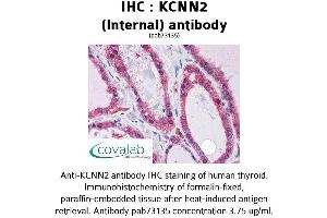 Image no. 2 for anti-Potassium Intermediate/small Conductance Calcium-Activated Channel, Subfamily N, Member 2 (KCNN2) (AA 545-557), (Internal Region) antibody (ABIN1736194) (KCNN2 anticorps  (Internal Region))