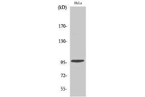 Western Blotting (WB) image for anti-Checkpoint Kinase 2 (CHEK2) (pThr68) antibody (ABIN5961583) (CHEK2 anticorps  (pThr68))