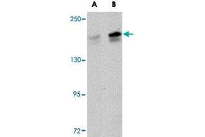 Western blot analysis of PALB2 in SK-N-SH cell lysate with PALB2 polyclonal antibody  at (A) 1 and (B) 2 ug/mL .