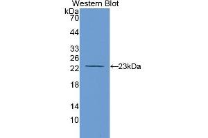 Detection of Recombinant MMP12, Rat using Polyclonal Antibody to Matrix Metalloproteinase 12 (MMP12)