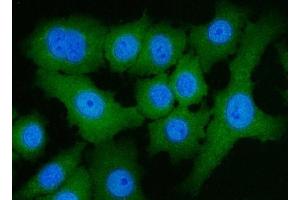 IF analysis of ACLY using anti-ACLY antibody (ABIN4886416).
