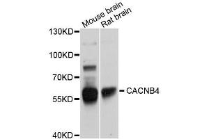 Western blot analysis of extracts of various cell lines, using CACNB4 antibody (ABIN5996096) at 1/1000 dilution. (CACNB4 anticorps)