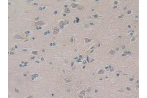 Detection of PIK3C3 in Human Cerebrum Tissue using Polyclonal Antibody to Phosphoinositide-3-Kinase Class 3 (PIK3C3)