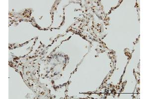 Immunoperoxidase of monoclonal antibody to BIK on formalin-fixed paraffin-embedded human lung.