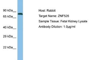 Host: Rabbit Target Name: ZNF526 Sample Type: Fetal Kidney lysates Antibody Dilution: 1. (ZNF526 anticorps  (N-Term))