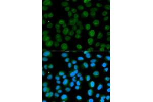Immunofluorescence analysis of HeLa cells using EMD antibody. (Emerin anticorps  (AA 1-220))