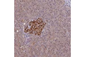 Immunohistochemical staining of human pancreas with ARHGAP19 polyclonal antibody  shows strong cytoplasmic positivity in islets of Langerhans. (ARHGAP19 anticorps)