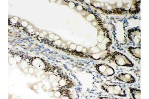 Anti-PKC epsilon Picoband antibody, (ABIN3043908), IHC(P)IHC(P): Rat Intestine Tissue (PKC epsilon anticorps  (AA 53-236))