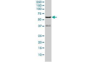 STK4 monoclonal antibody (M01), clone 1D7-8A10 Western Blot analysis of STK4 expression in Hela S3 NE .