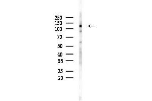anti-BMP2 Inducible Kinase (BMP2K) (Internal Region) antibody
