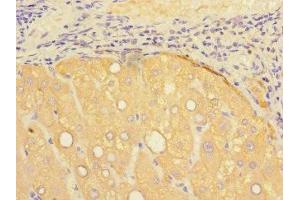 Immunohistochemistry of paraffin-embedded human liver tissue using ABIN7164264 at dilution of 1:100 (Presenilin 1 anticorps  (AA 4-218))