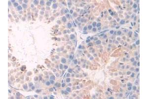 IHC-P analysis of Mouse Testis Tissue, with DAB staining. (TNFRSF1A anticorps  (AA 239-433))