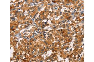 Immunohistochemistry (IHC) image for anti-Cell Division Cycle 25 Homolog B (S. Pombe) (CDC25B) antibody (ABIN2426696) (CDC25B anticorps)