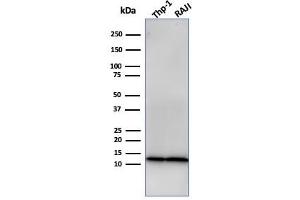 Western Blot Analysis of THP-1 and Raji Cell lysate using Beta-2-Microglobulin Mouse Recombinant Monoclonal Antibody (rB2M/961).